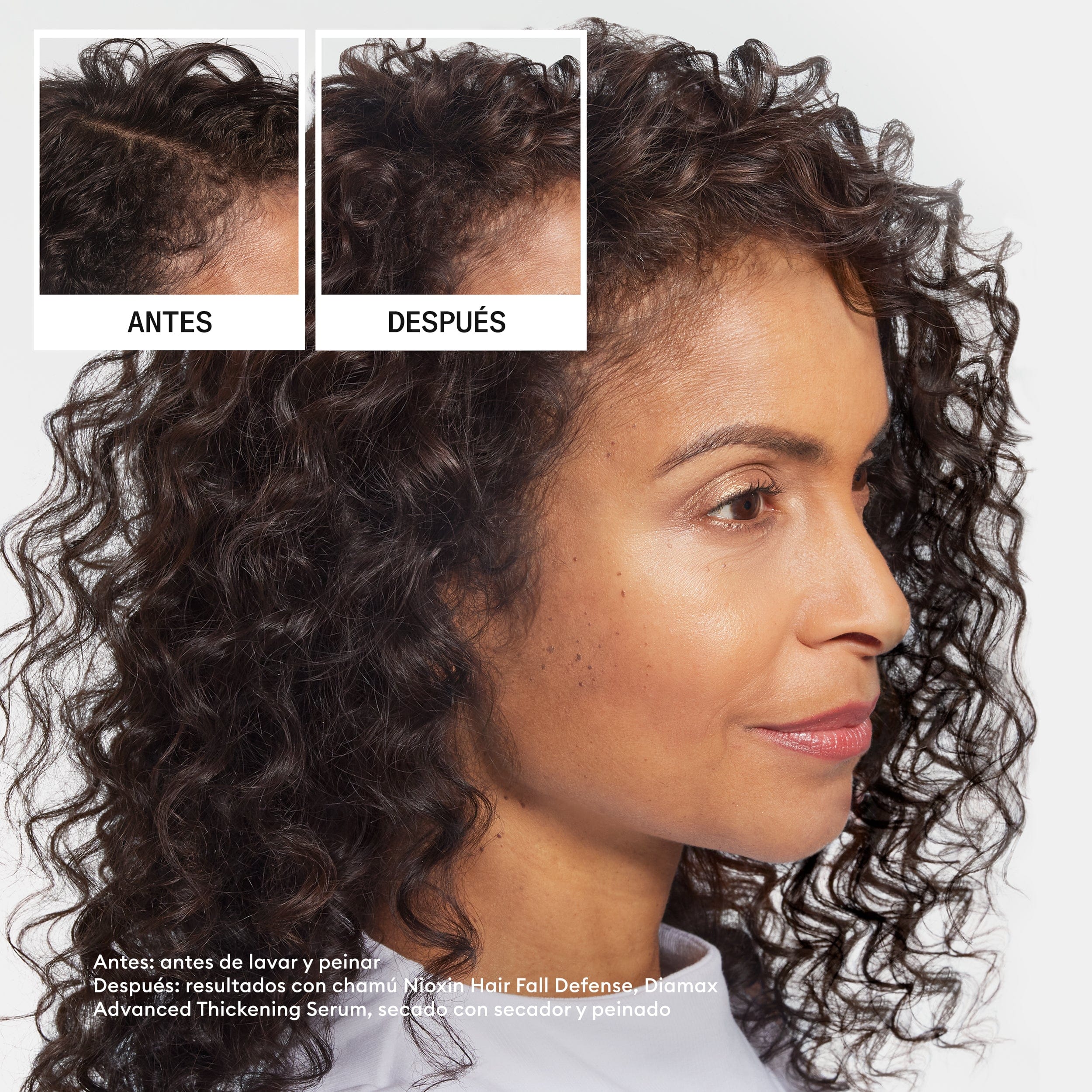 ANTI HAIR LOSS Champú Anticaída 240ml - Image 5